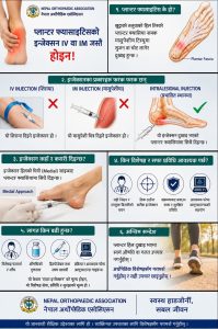 plantar fasciitis injection